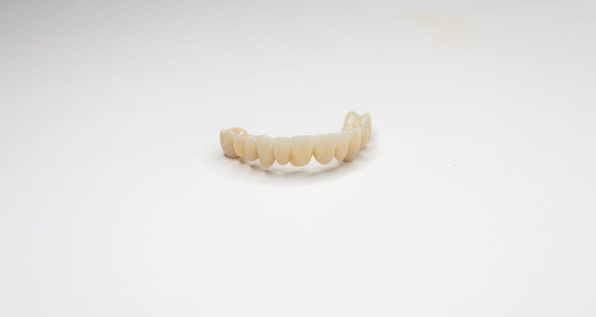 Implanty zębów: ile kosztują? Czy cena usługi ma znaczenie?