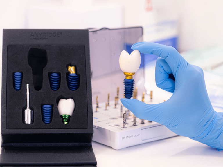 Rodzaje implantów stomatologicznych. Przewodnik dla pacjentów