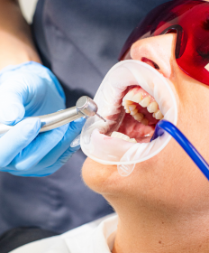 Co to jest stomatologia zachowawcza?