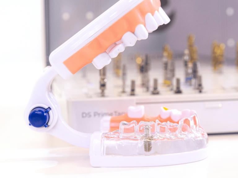 Dobry implantolog we Wrocławiu – jak go wybrać?