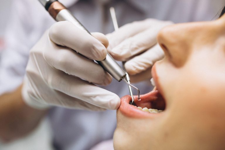 Jak wygląda leczenie paradontozy u periodontologa – krok po kroku